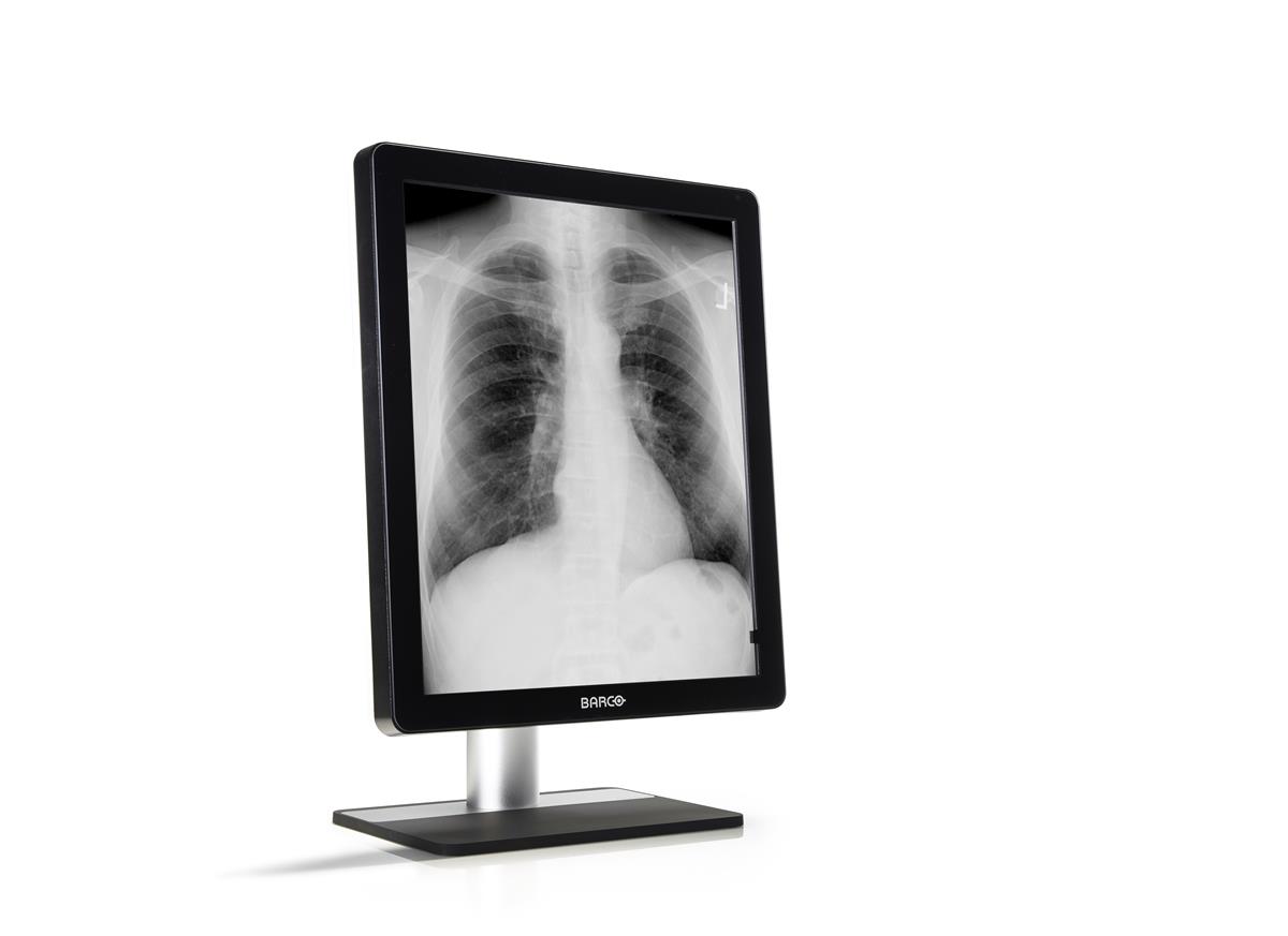 monitor medicale