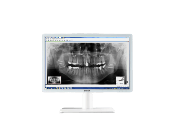 monitor medicale