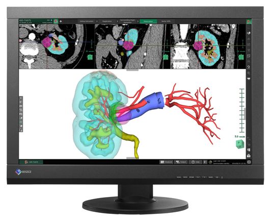 monitor medicale