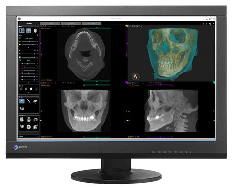 monitor medicale
