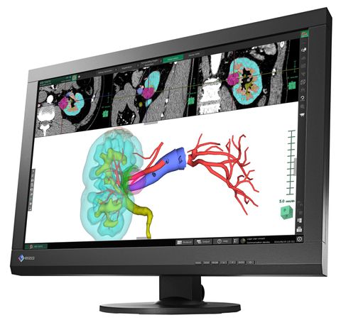 monitor medicale