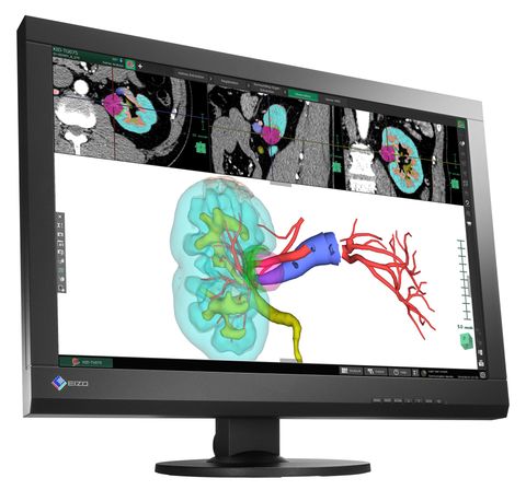 monitor medicale