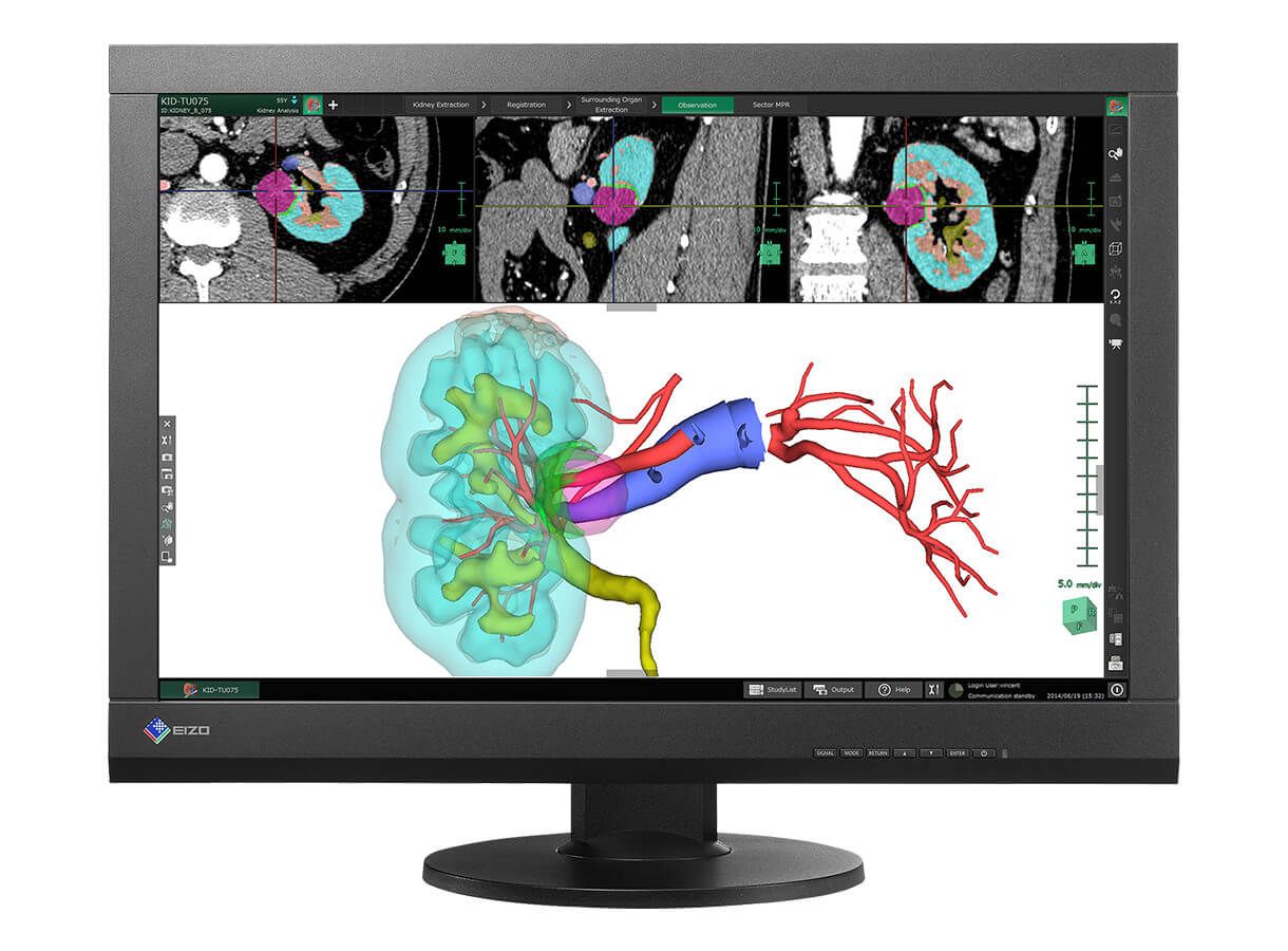 monitor medicale