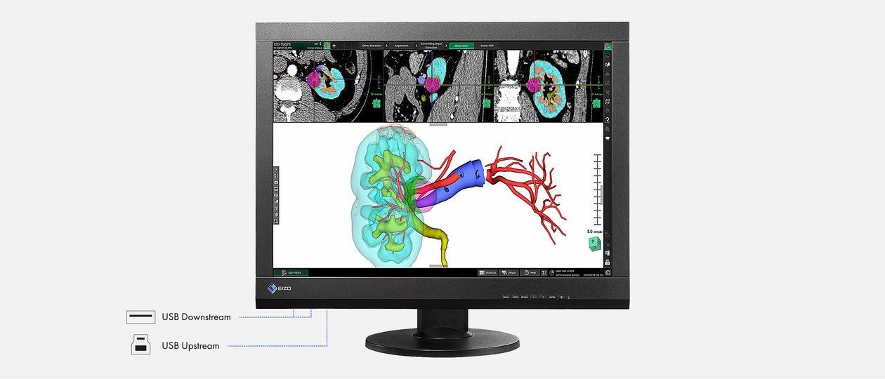 monitor medicale