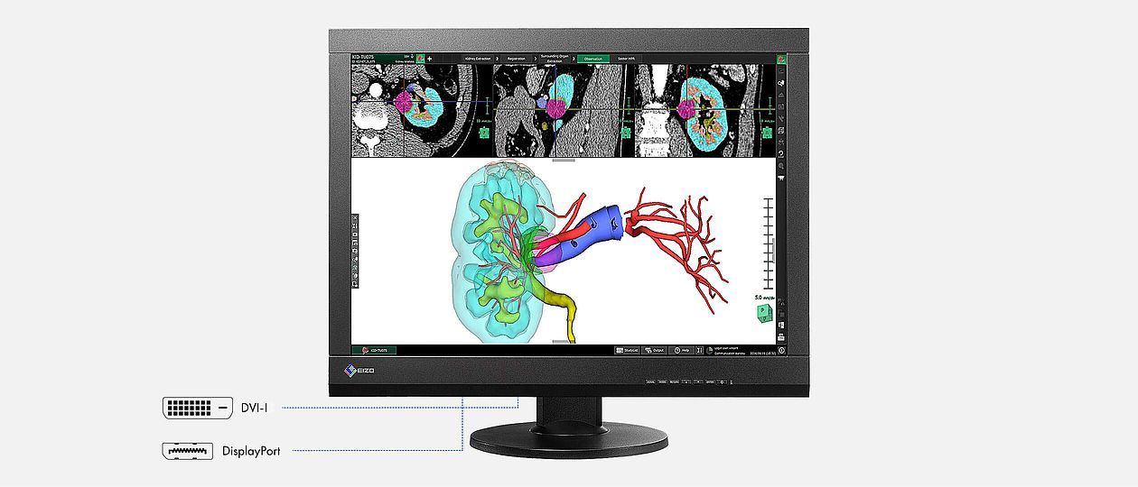monitor medicale
