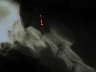 Radiographie
