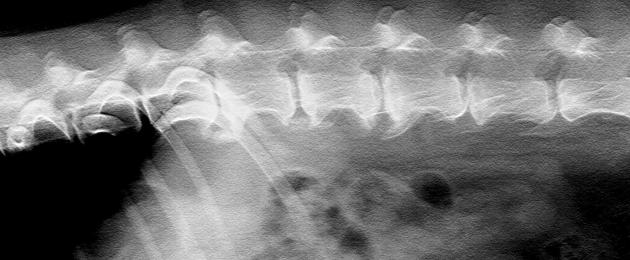 Radiographie