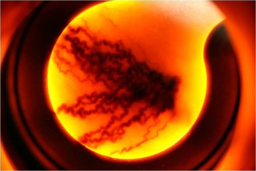 Veinlite Transillumination Anwendung 1