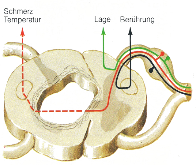 Buchautorin, Selbsthilfe, Syringomyelie, Chiari Malformation