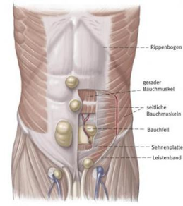 Diagramm der Bauchmuskulatur mit Beschriftungen in deutscher Sprache: Rippenkorb, gerader Bauchmuskel, schräger Bauchmuskel, Bauchfell, Aponeurose, Leistenband.