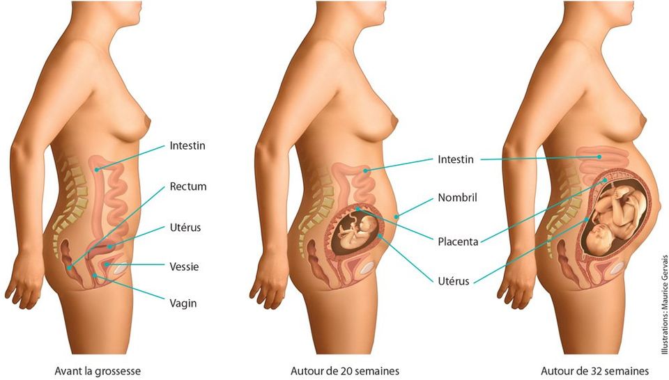 Douleurs De La Symphyse Pubienne Chez La Femme Enceinte Le Syndrome De Lacomme