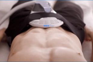 MBS Shape System