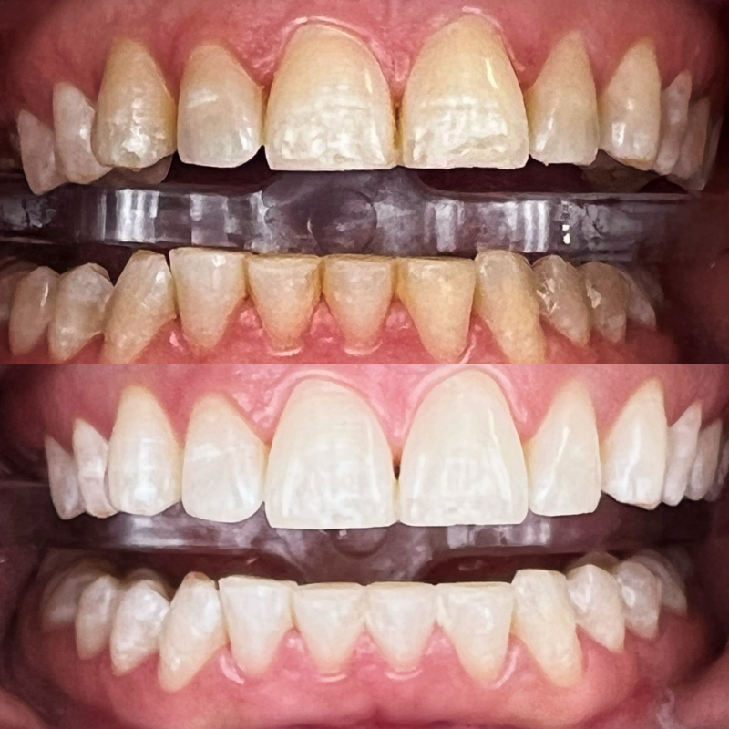 weiteres Beispiel nach 3 Durchgängen