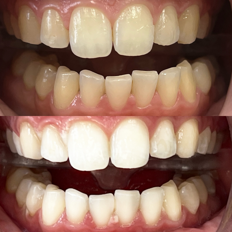 Noch ein erfolgreiches Beispiel