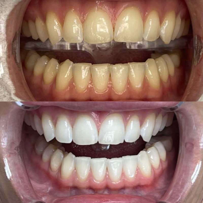 Nach 4 Durchgängen a 15 Minuten