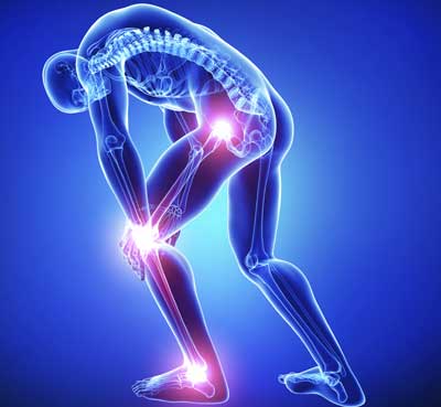 Artrosis, Osteoartritis