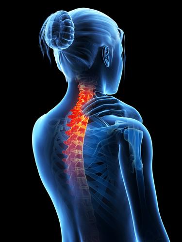 Dolor Cuello