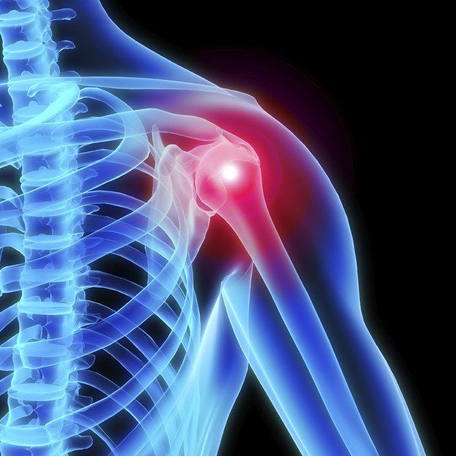 Nervio supraescapular