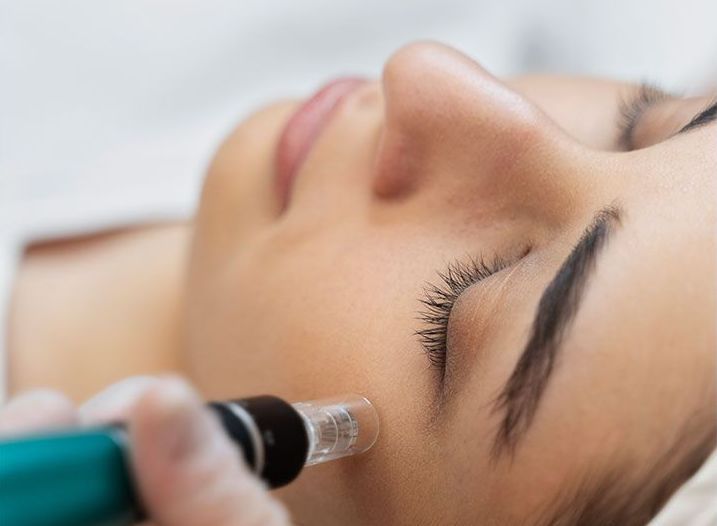 HydraFacial Treatment – langfristige Hautgesundheit und sofortiger Glow-Effekt by Sveya