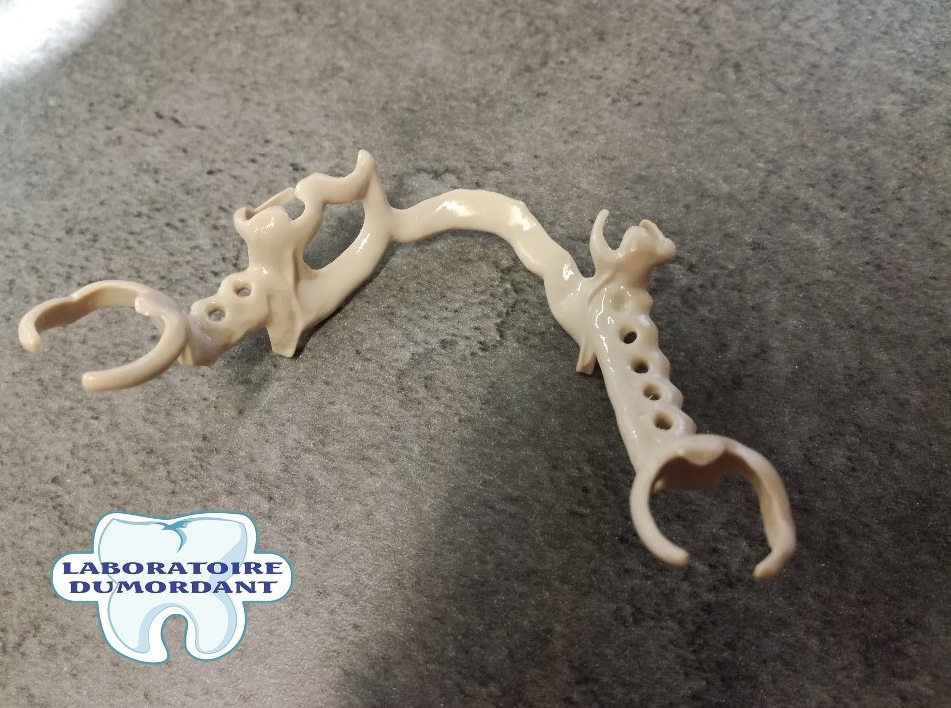 Prothèse Amovible Définitive Complète Unimaxillaire à Plaque Base Résine