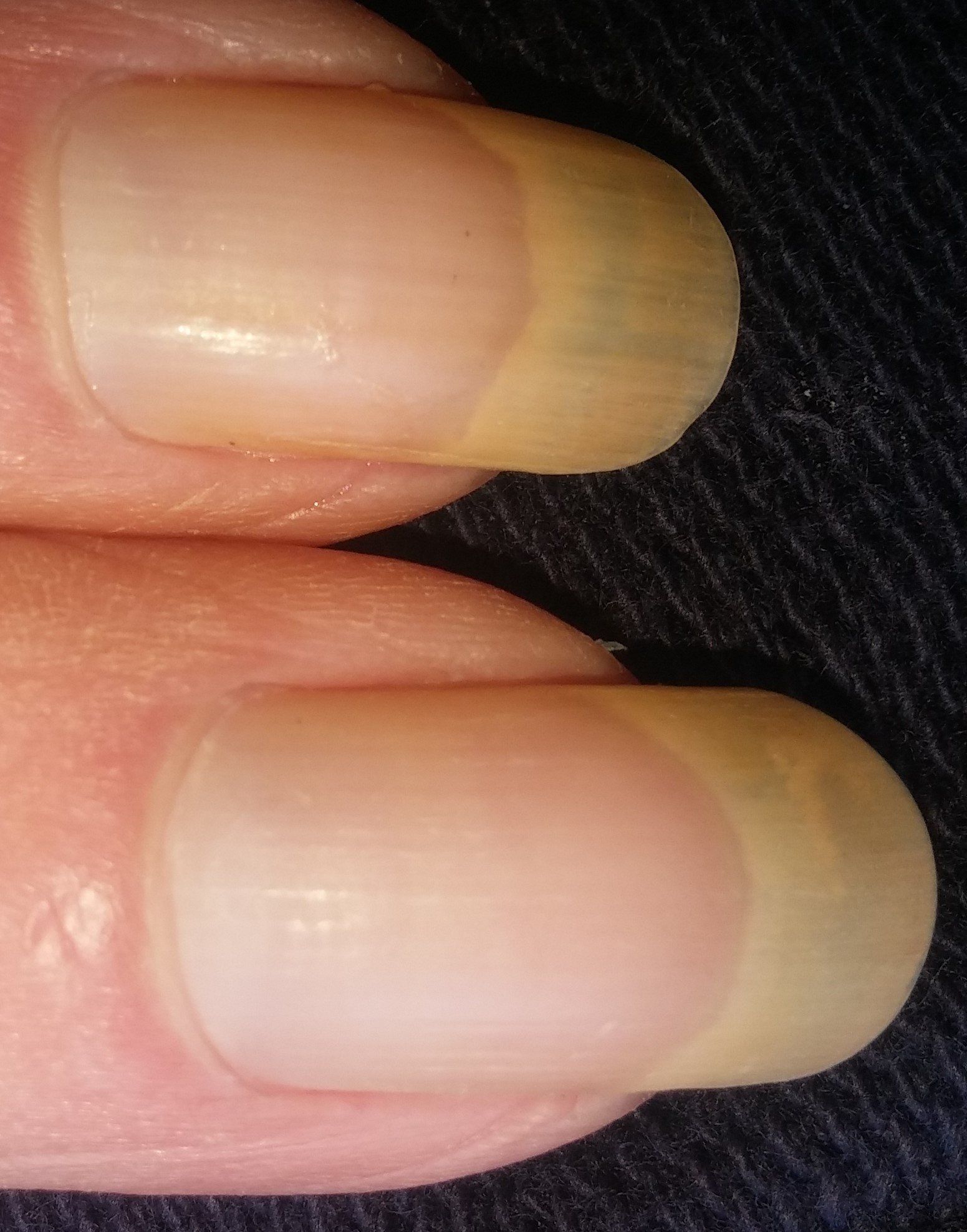 health_deteriorating