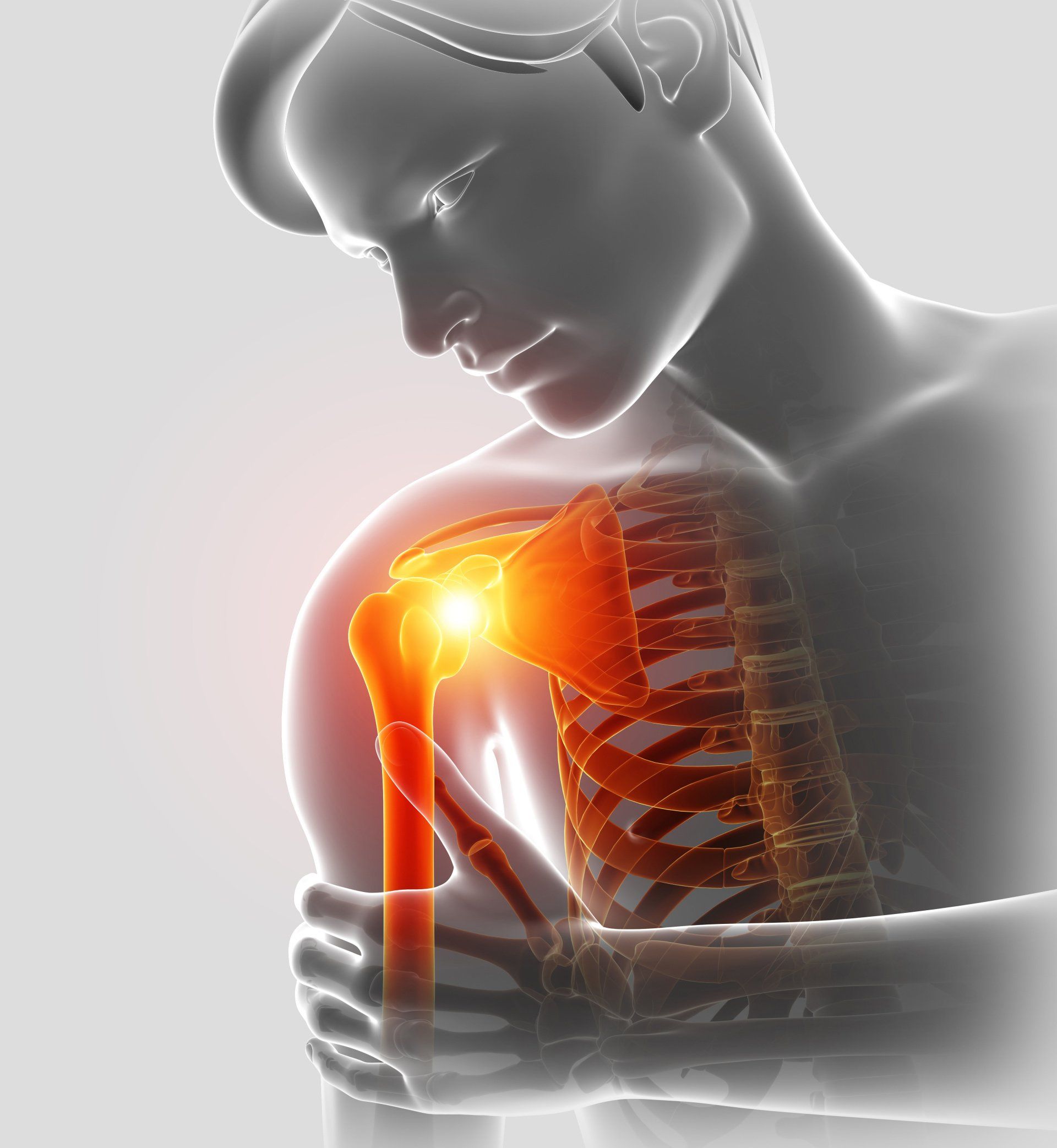 Osteopathie, Chiropraktik, frozen shoulder, kapselmuster