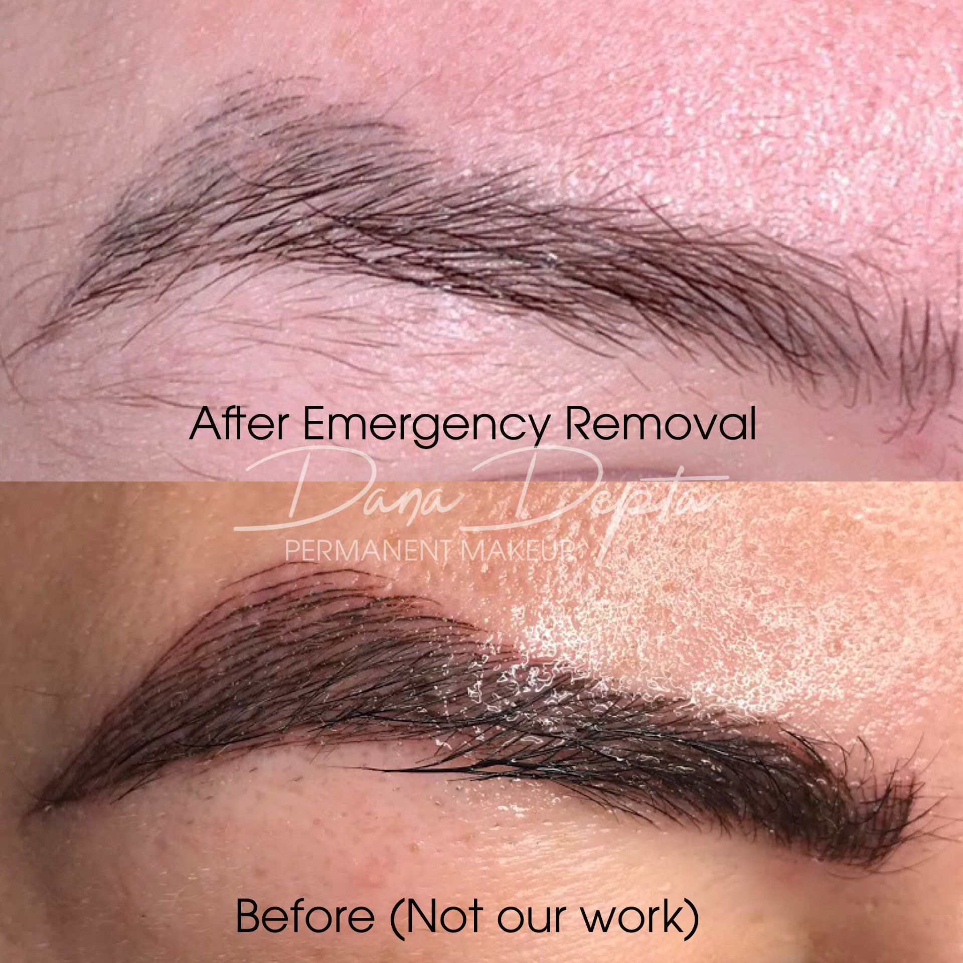 Saline Removal Photos Dana Depta Permanent Makeup