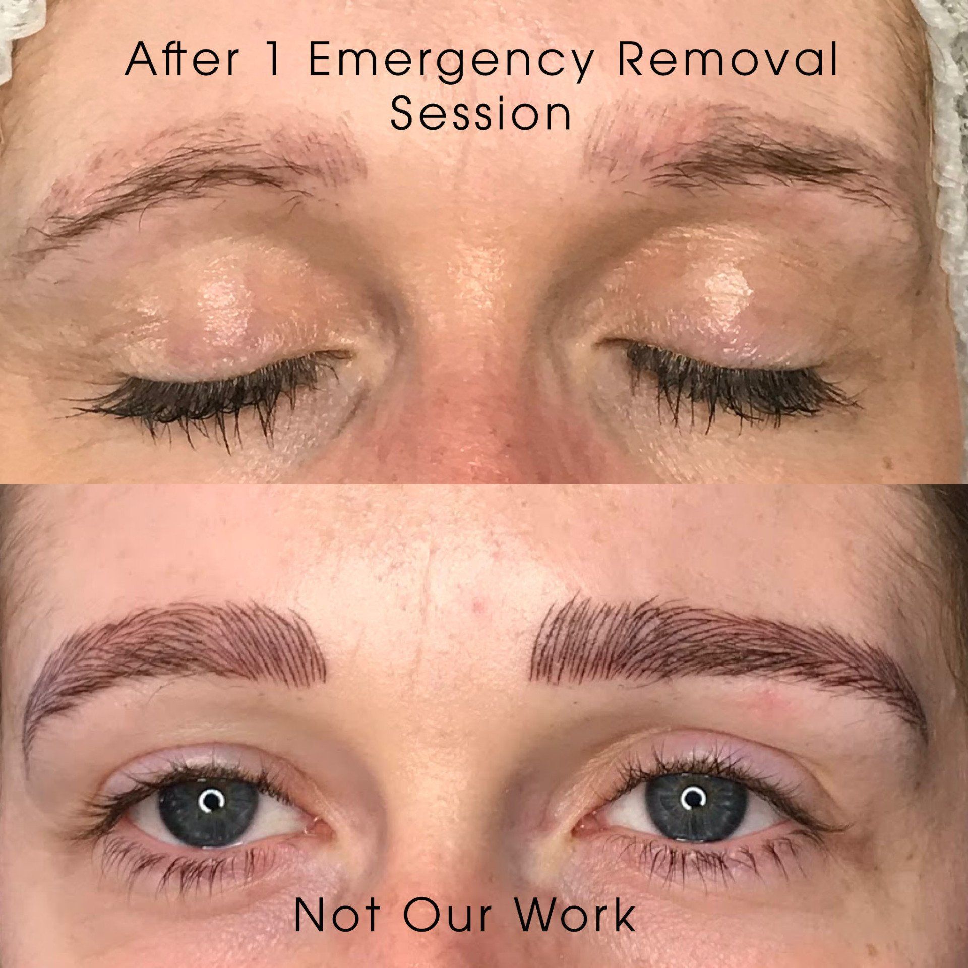 Semi permanent make up removal