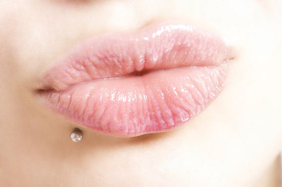 Lippen aufspritzen limburg, hyaluron, eigenfett