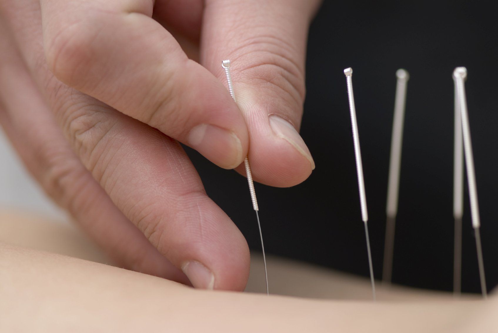 Home page image on Lauren Emsley Acupuncture linking to information on how acupuncture can benefit certain conditions
