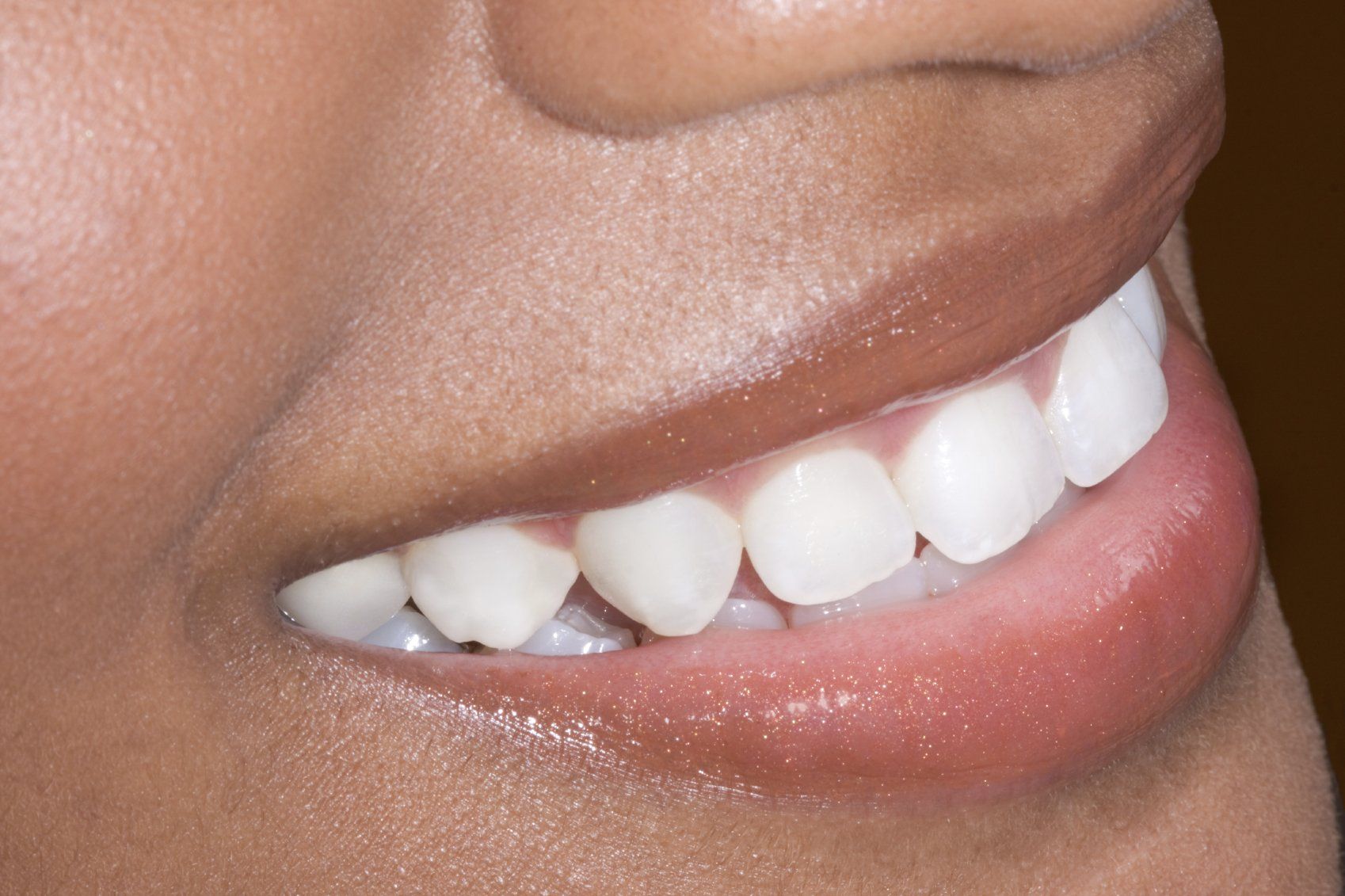 Zähne zeigen, ein wichtiges Schönheitsmerkmal