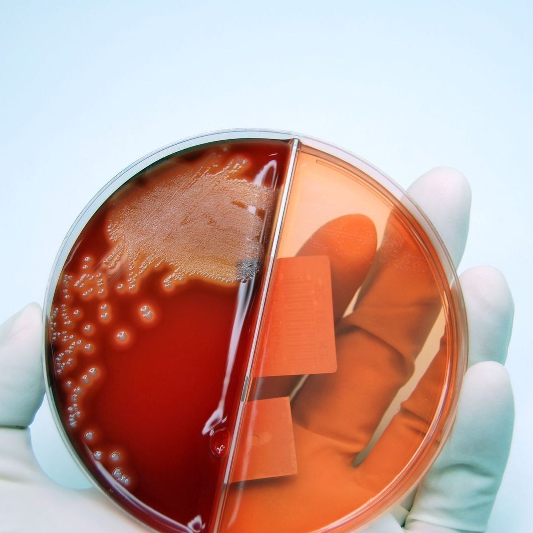 infection urinaire, gastro entérite, angine, vaginose