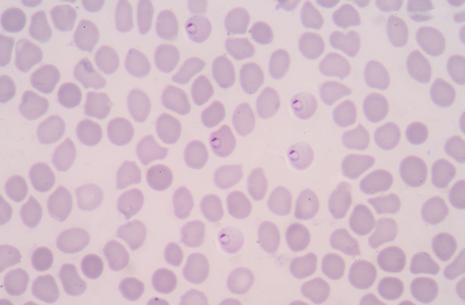 paludisme, amibiase, oxyurose