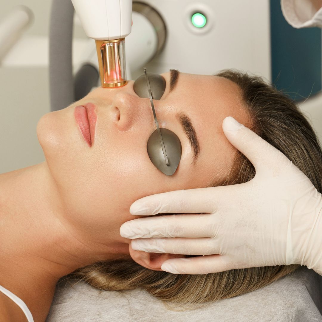 Fotorejuvenecimiento facial corrección de manchas faciales: