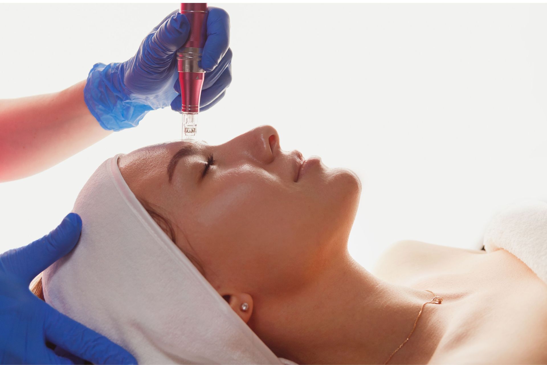 Tratamiento facial dermapen