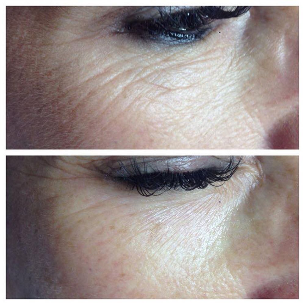 Vegas Cosmetics Skin Cell Tronic