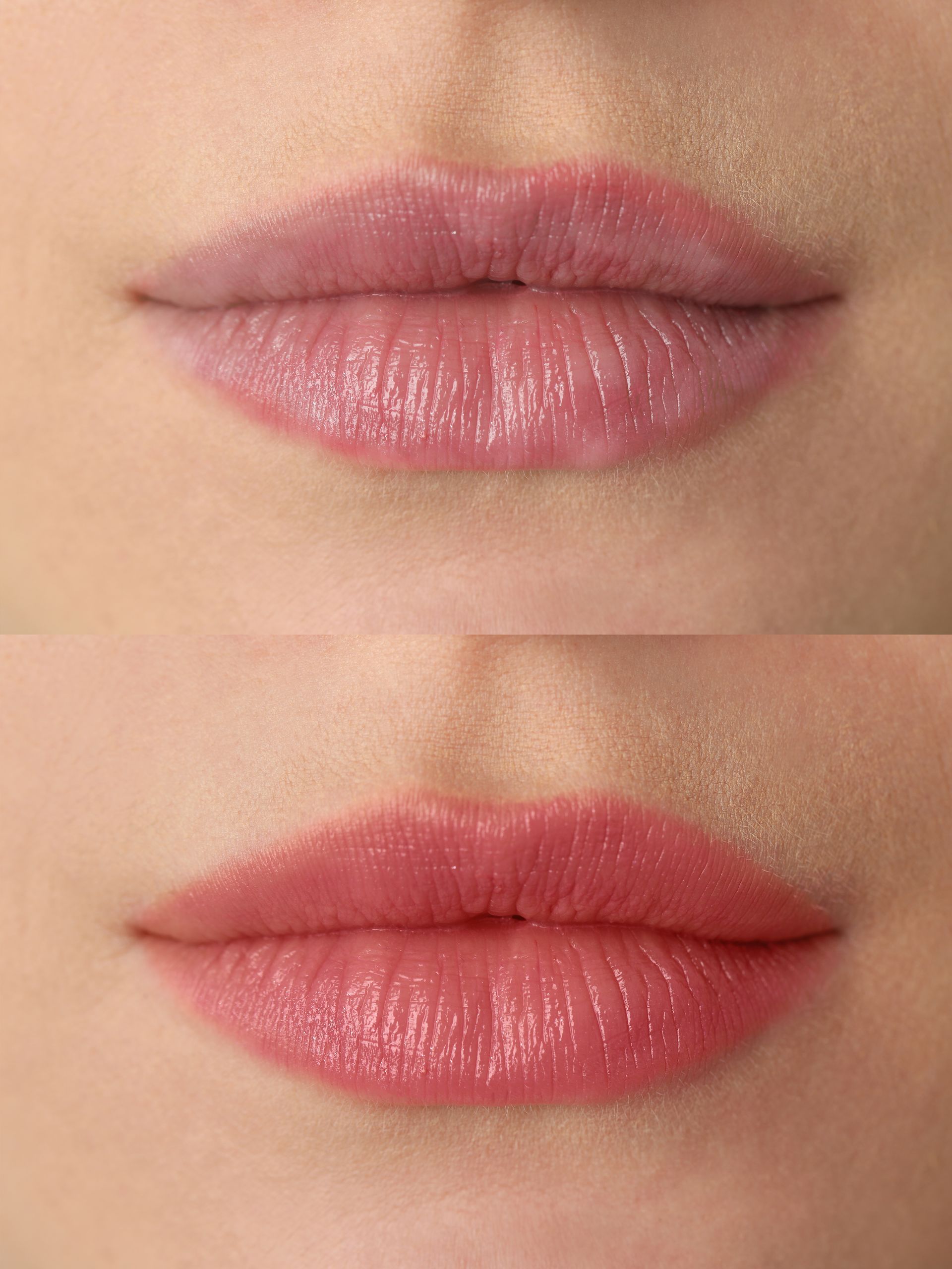 Lippen vor der Lippenpigmenteierung bei Kosmetik Reichel in Dessau.