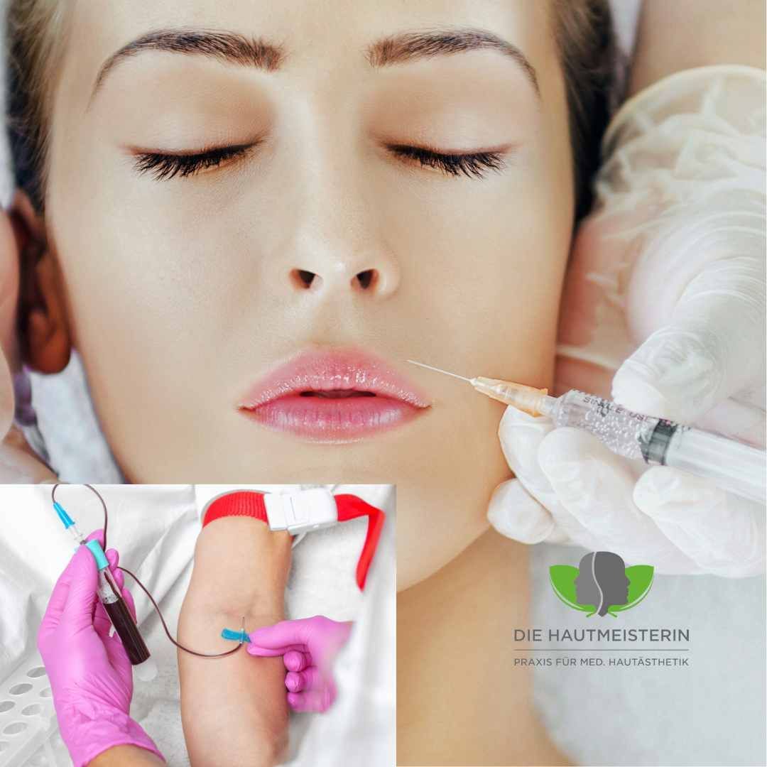 Botox-Behandlung in Lüneburg – Faltenreduzierung für ein glattes, frisches Aussehen.