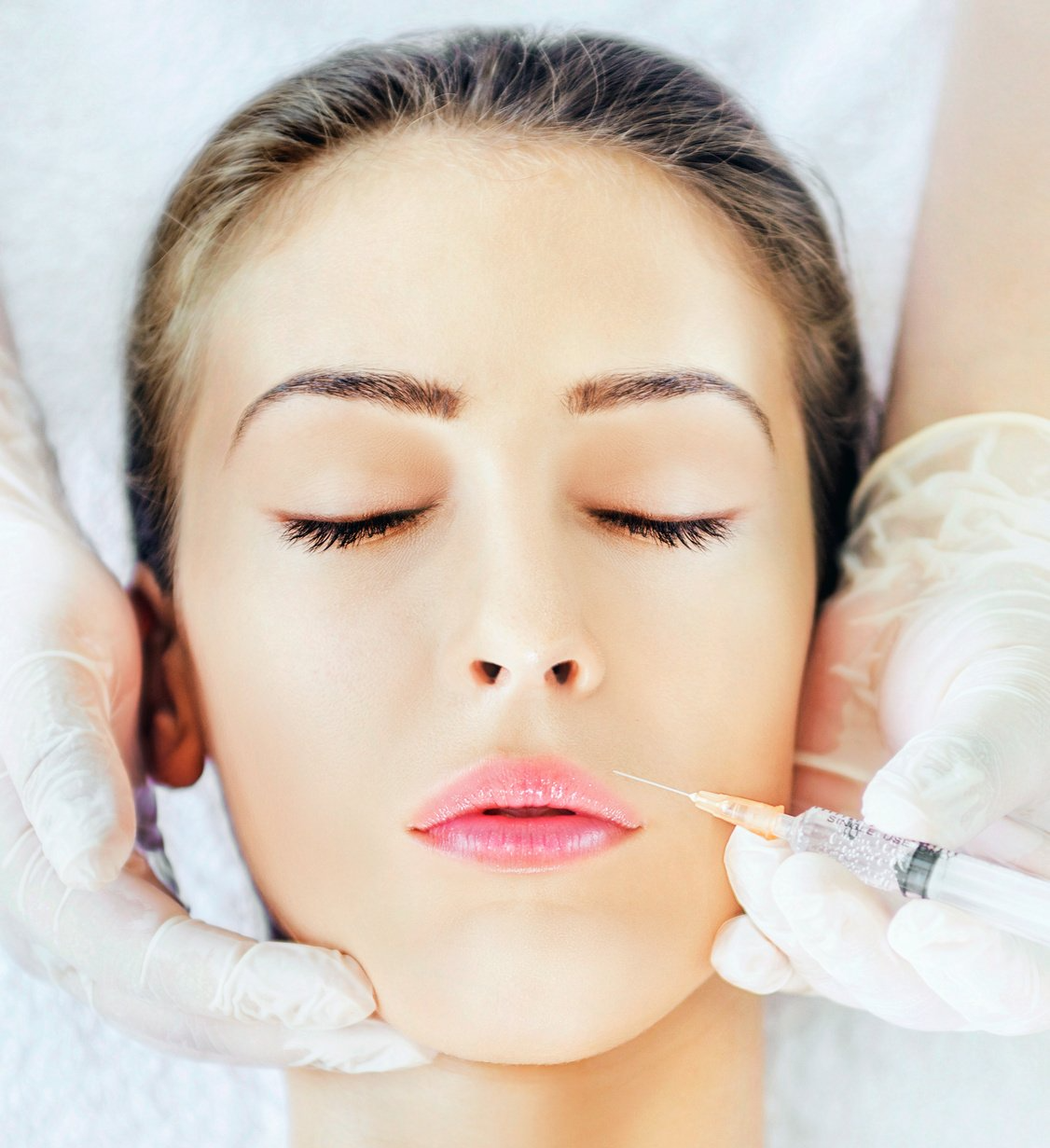 Lip Flip mit Botox in Lüneburg – sanfte Betonung der Lippenkontur für einen natürlichen Look.