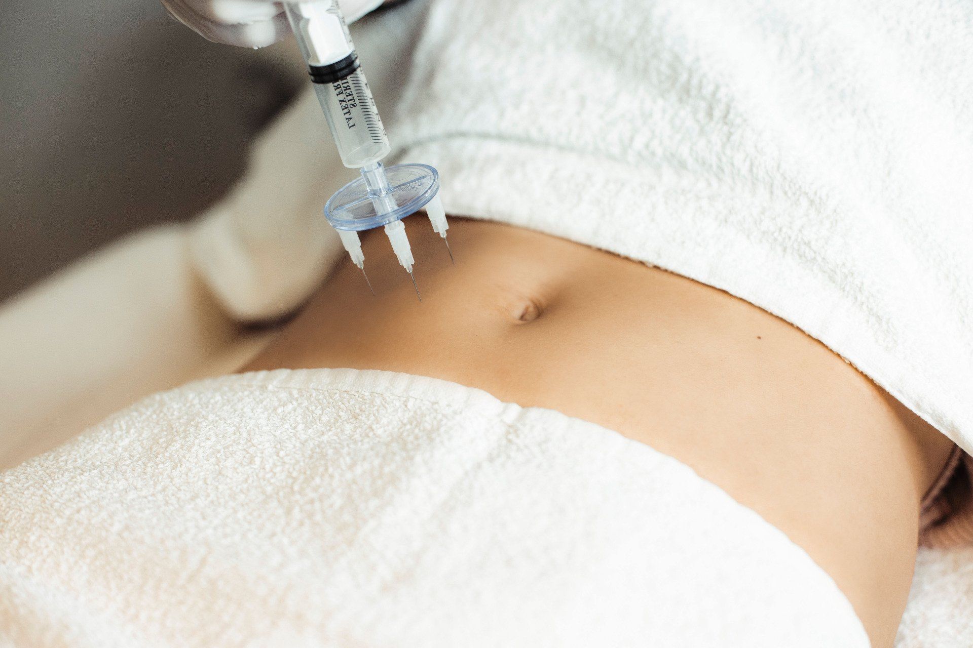 Fett-Weg-Spritze & Kryolipolyse in Lüneburg – gezielte Fettreduktion ohne OP.