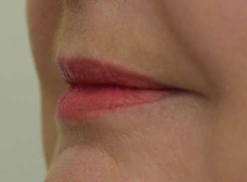 Lips Before Picture Dr Ruth Brady