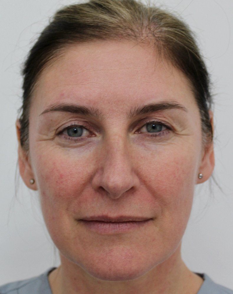 Full face Before Picture Dr Ruth Brady