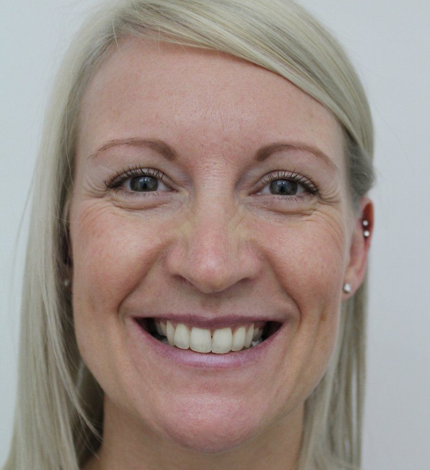 Full face Before Picture Dr Ruth Brady