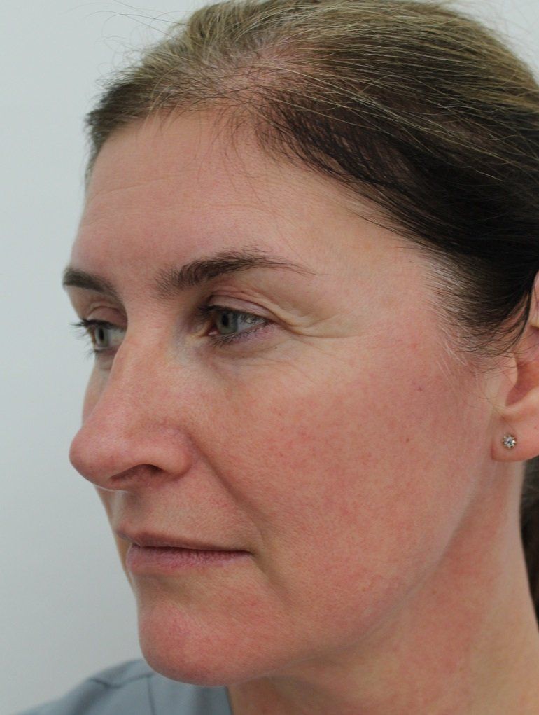 Full face Before Picture Dr Ruth Brady
