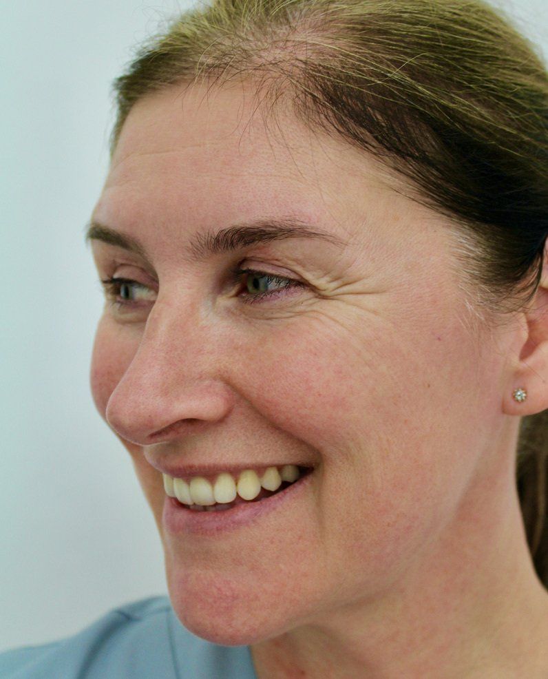 Full face Before Picture Dr Ruth Brady