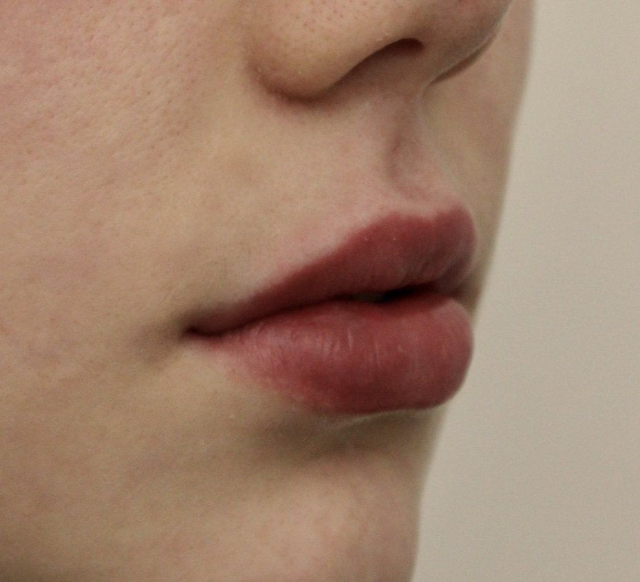 Picture of Lips by Dr Ruth Brady