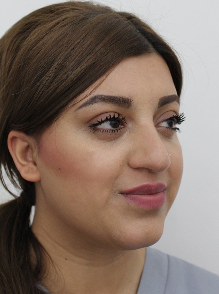 Picture of facial slimming treatment by Dr Ruth Brady