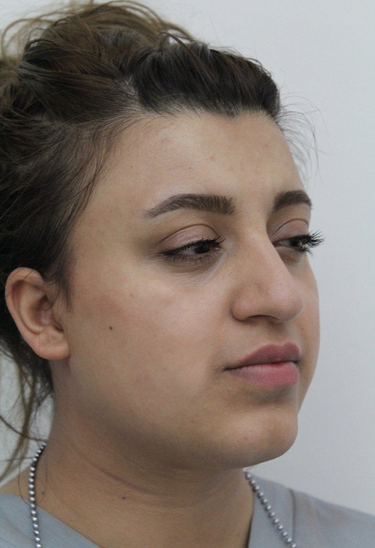 Face Before Picture Dr Ruth Brady