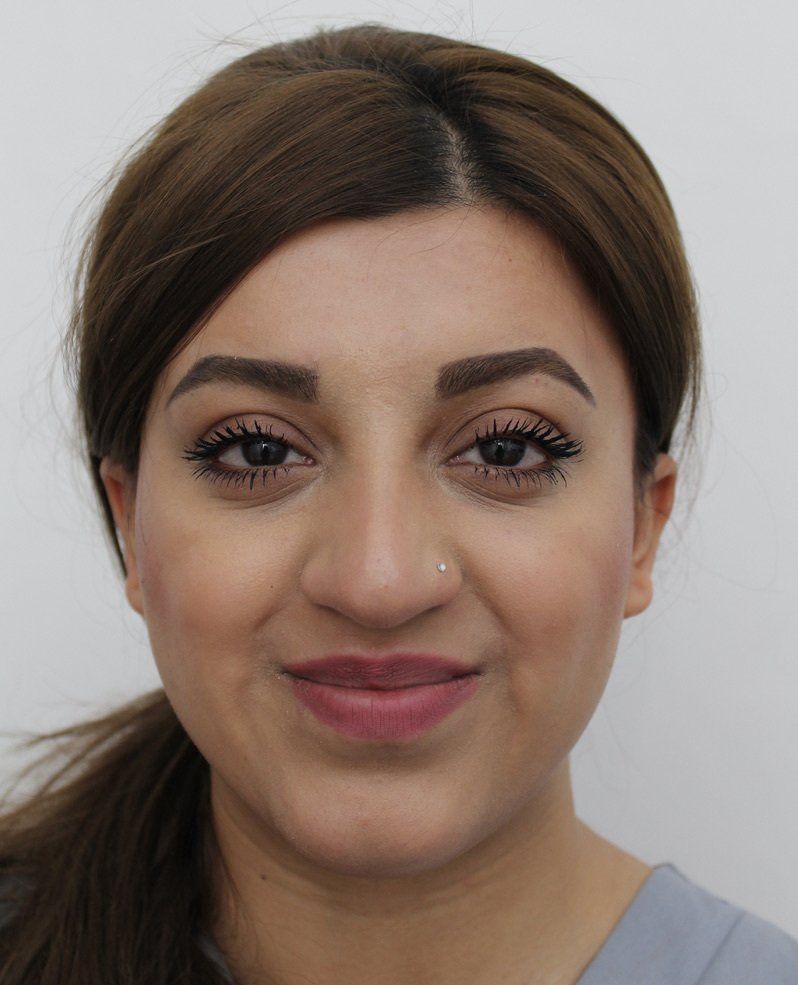 Picture of facial slimming treatment by Dr Ruth Brady