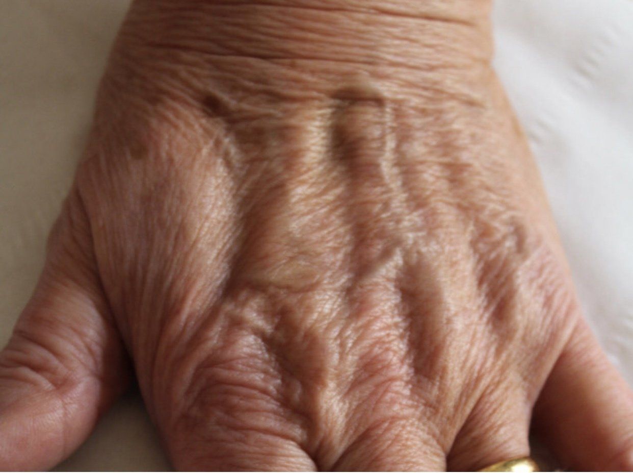 Hands Before Picture Dr Ruth Brady